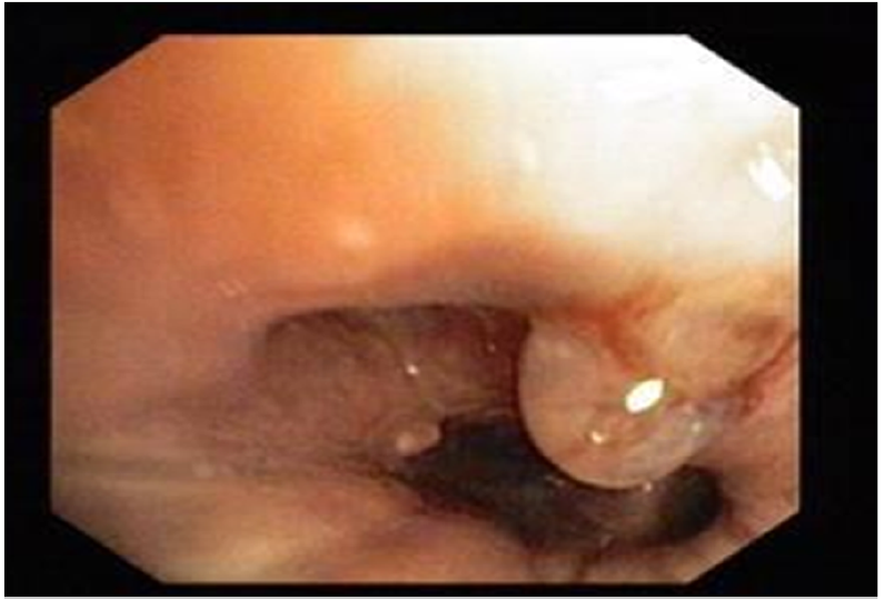 f:id:AppleQQ:20210224202006p:plain