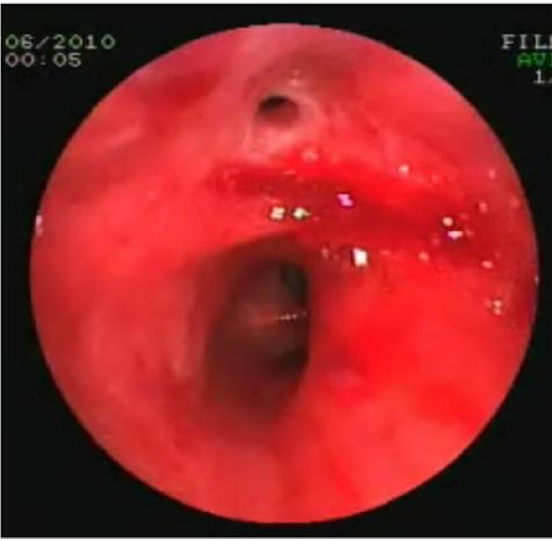 f:id:AppleQQ:20210224202041p:plain