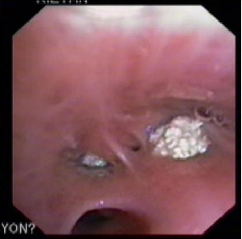 f:id:AppleQQ:20210224202100p:plain