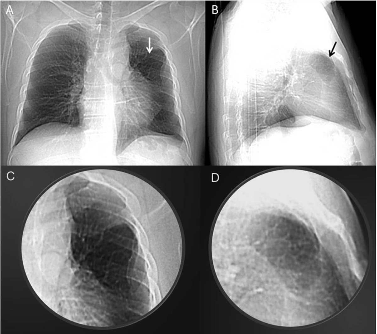 f:id:AppleQQ:20210306154536p:plain