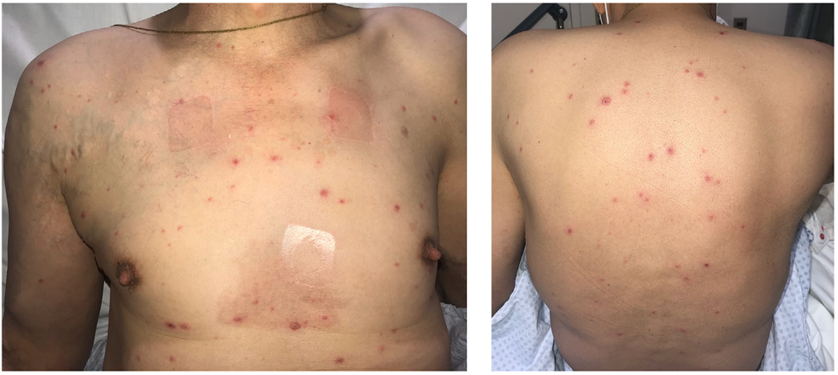 f:id:AppleQQ:20210726175433p:plain