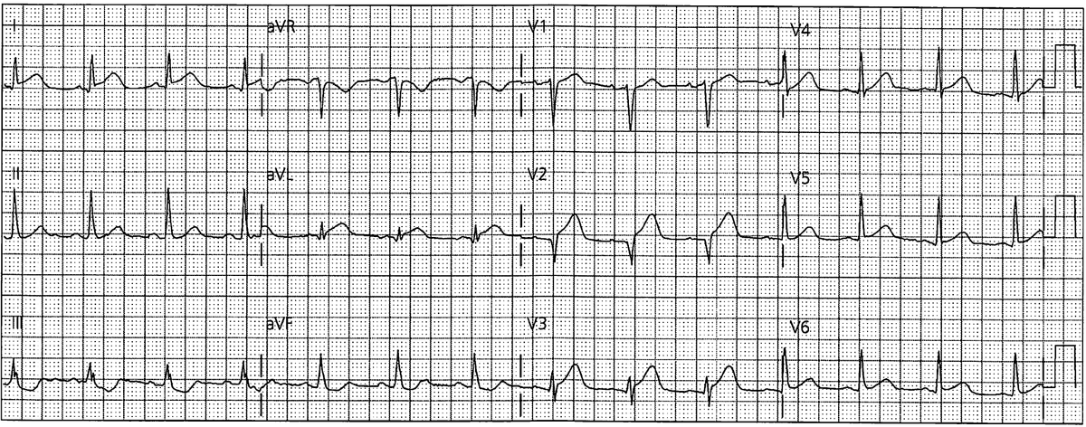 f:id:AppleQQ:20220225200228p:plain