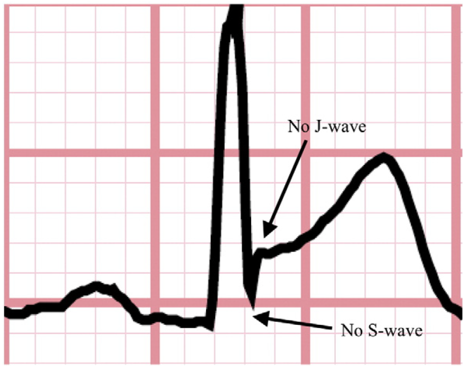 f:id:AppleQQ:20220225205102p:plain