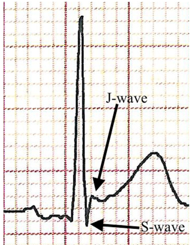 f:id:AppleQQ:20220225205138p:plain