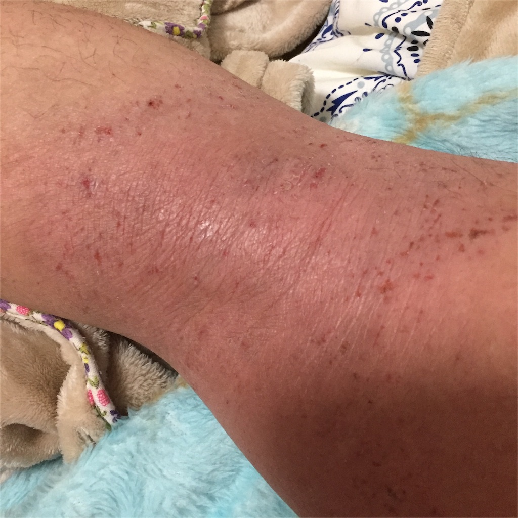 f:id:Aprciliegio:20170329093222j:image f:id:Aprciliegio:20170329093222j:image