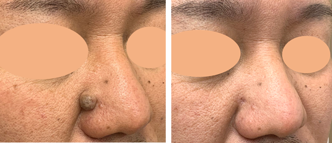 f:id:Aya-hifuka:20201020121535p:plain