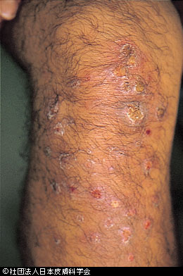 f:id:Aya-hifuka:20210713113557p:plain