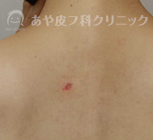 f:id:Aya-hifuka:20211005210943p:plain