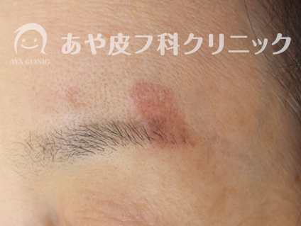 f:id:Aya-hifuka:20211005225511p:plain