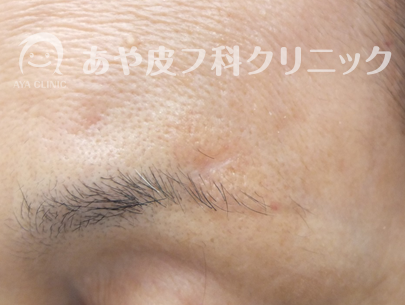 f:id:Aya-hifuka:20211005225540p:plain