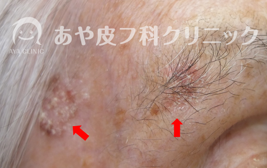 f:id:Aya-hifuka:20211005225552p:plain