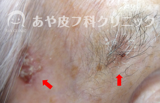 f:id:Aya-hifuka:20211005225610p:plain