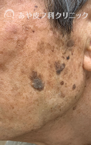 f:id:Aya-hifuka:20211006112525p:plain