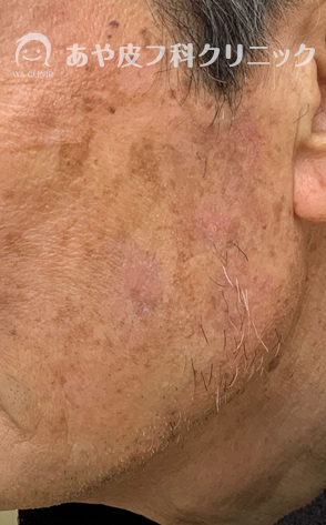 f:id:Aya-hifuka:20211006112539p:plain