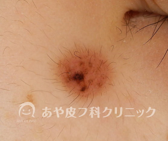 f:id:Aya-hifuka:20211122143303p:plain