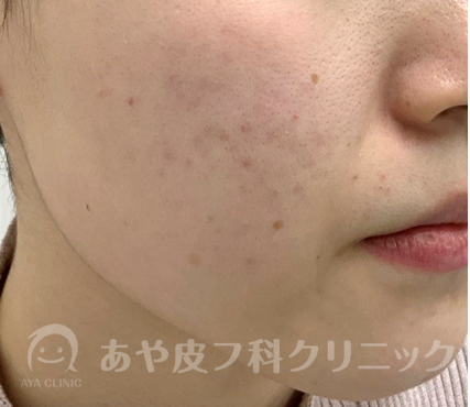 f:id:Aya-hifuka:20220215122621p:plain