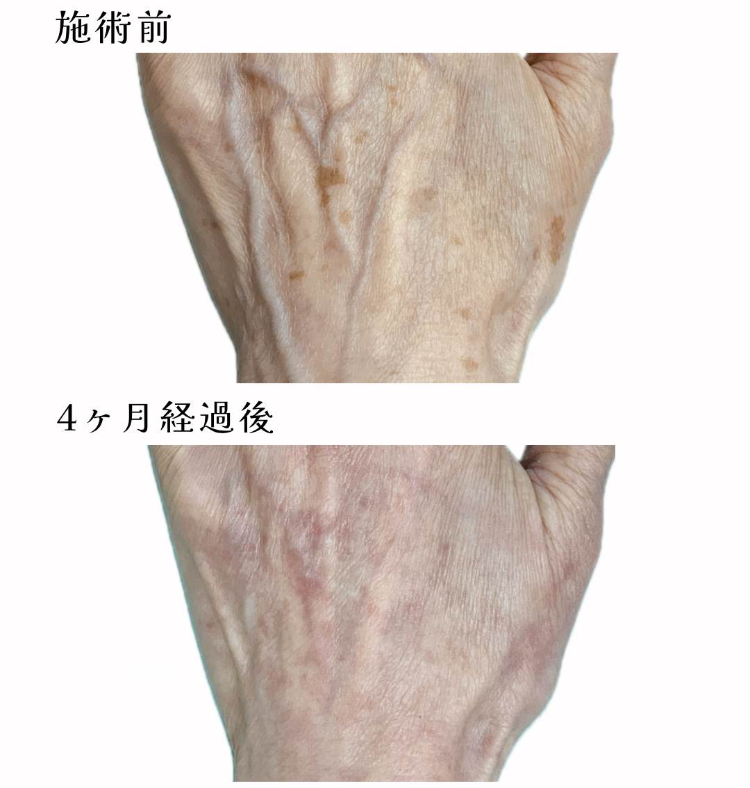 あや皮フ科クリニックのblog