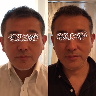 f:id:BRILLIANDROP:20180906130812j:plain