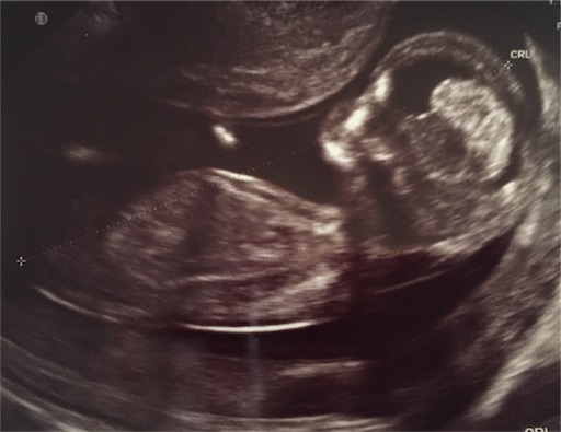 f:id:Barna:20170425200839j:image f:id:Barna:20170425200839j:image