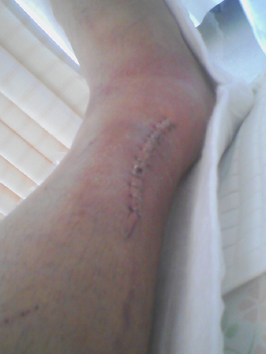 f:id:Blackcomb:20080728114535j:image:h500