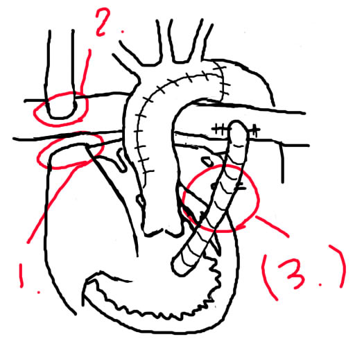 f:id:CALMIN:20160828012749j:plain