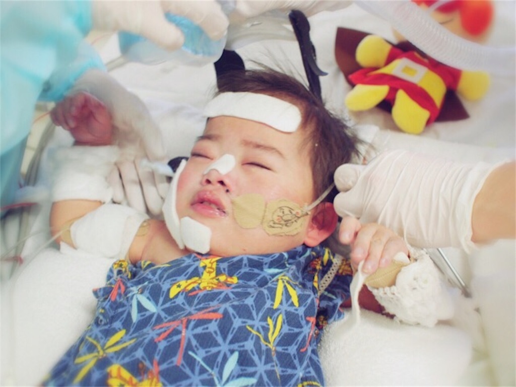 f:id:CALMIN:20180330205815j:plain