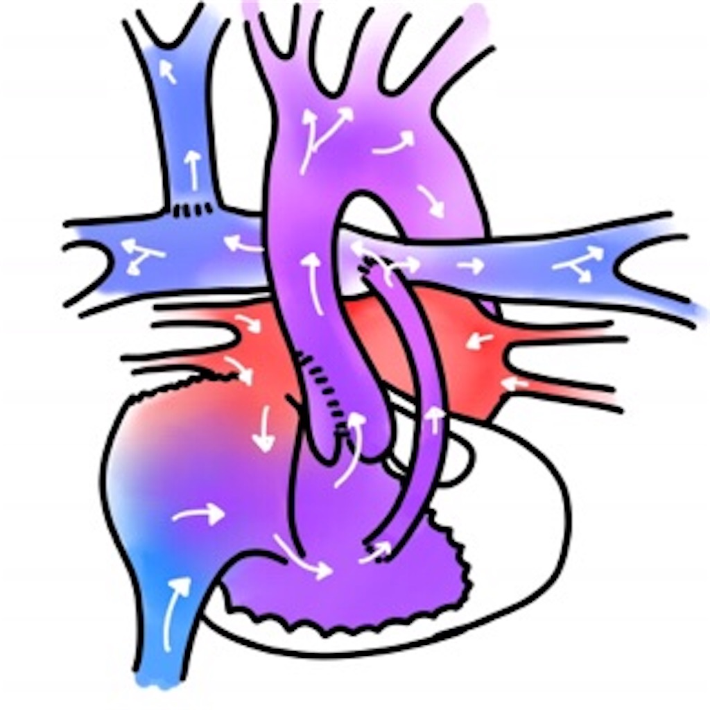 f:id:CALMIN:20181120232643j:plain