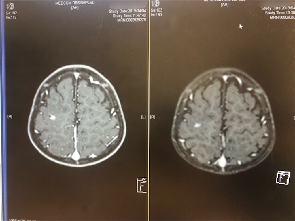 f:id:CALMIN:20190420224711j:image