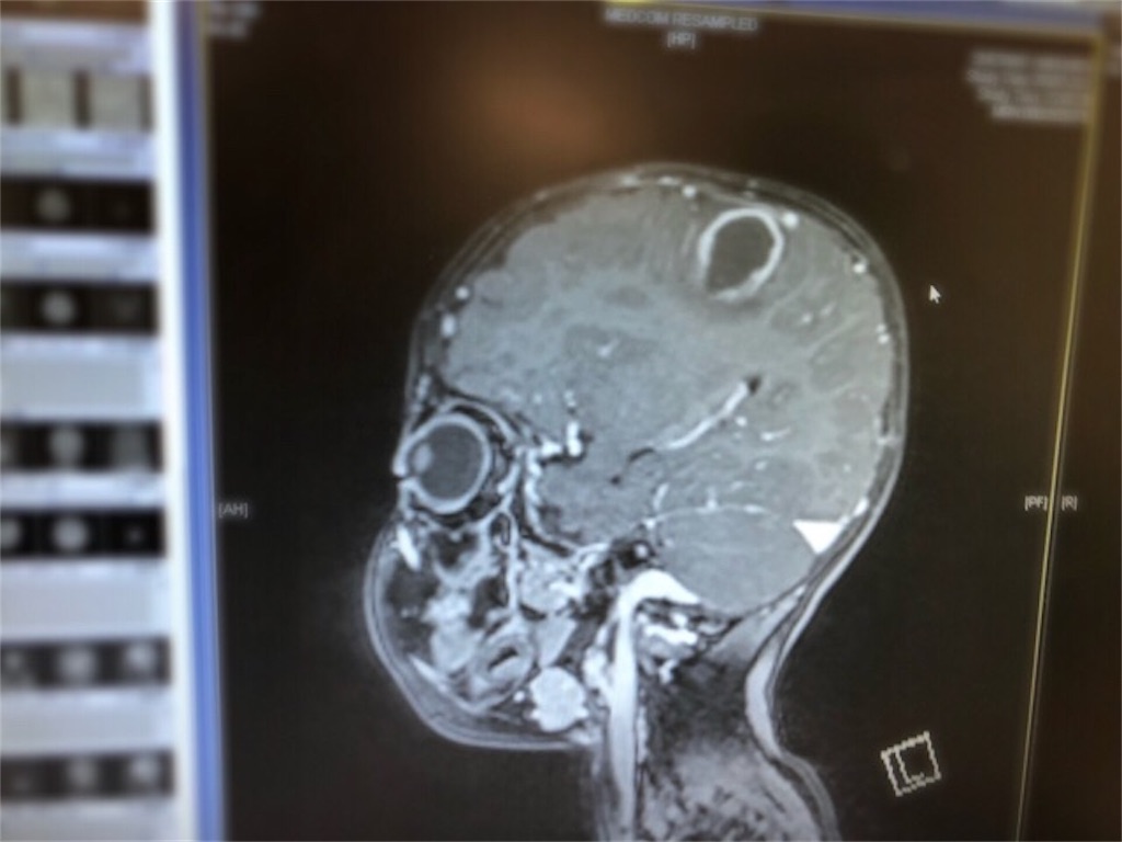 f:id:CALMIN:20190426085922j:image