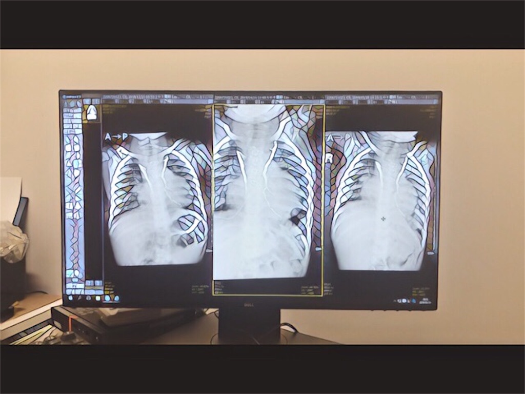 f:id:CALMIN:20190529213712j:image