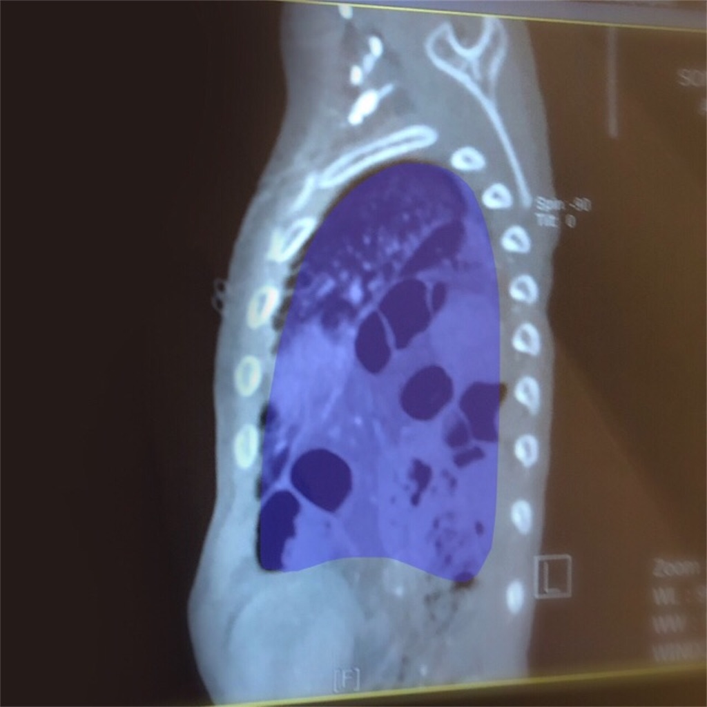 f:id:CALMIN:20190531063436j:image