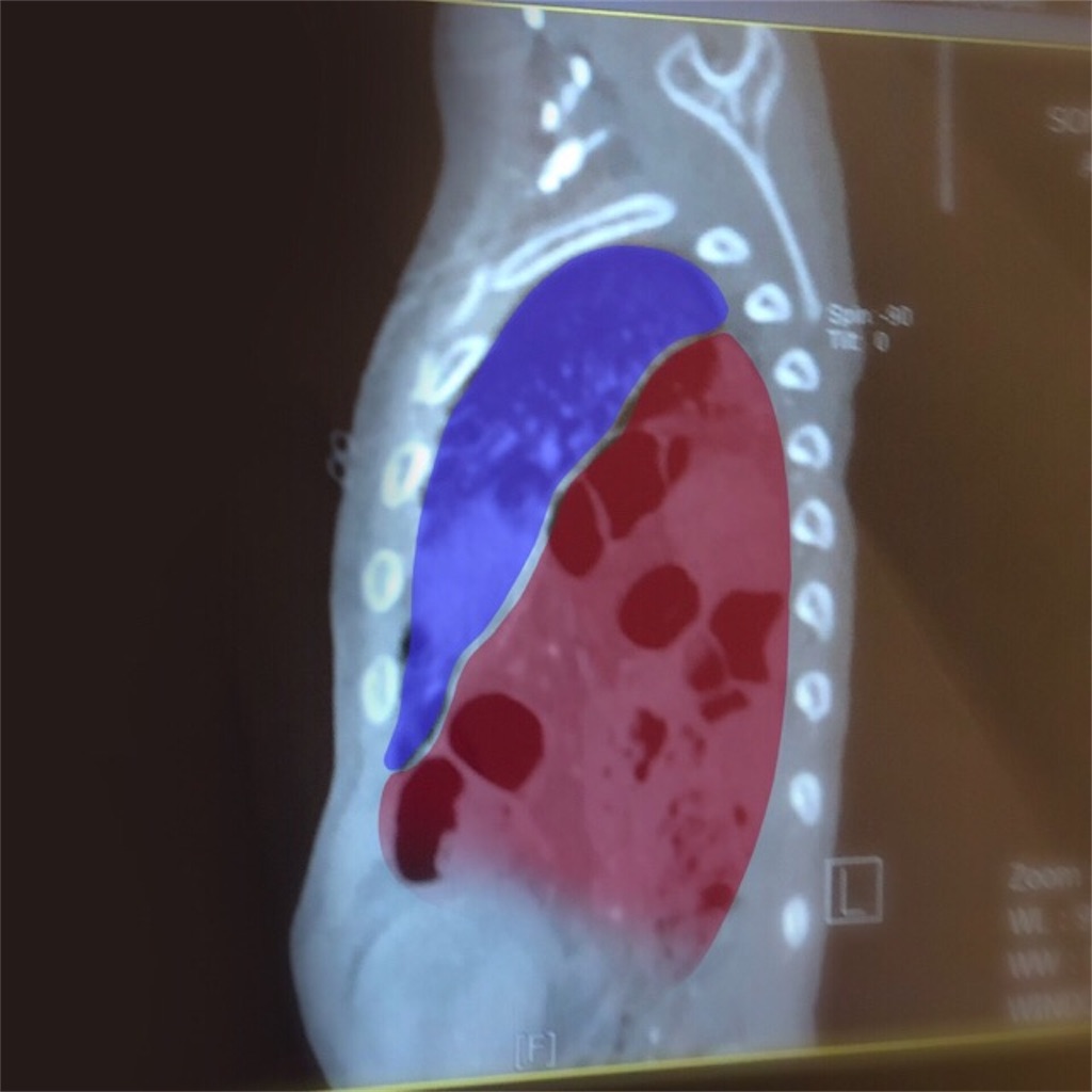 f:id:CALMIN:20190531063527j:image