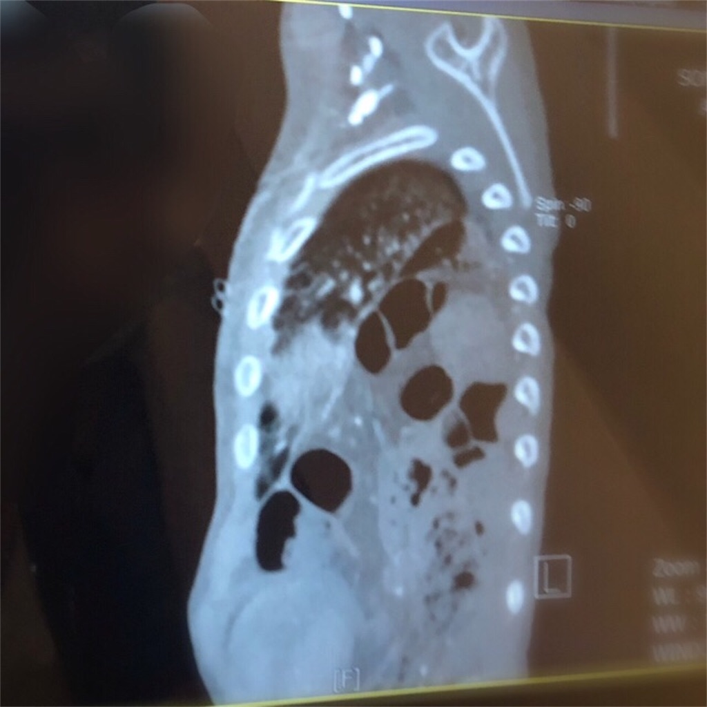 f:id:CALMIN:20190531081651j:image