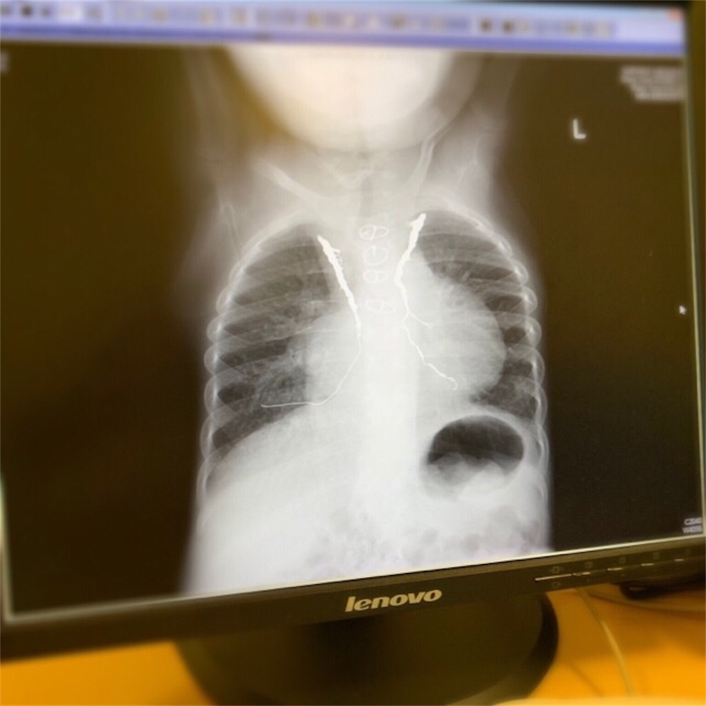 f:id:CALMIN:20190711222224j:image