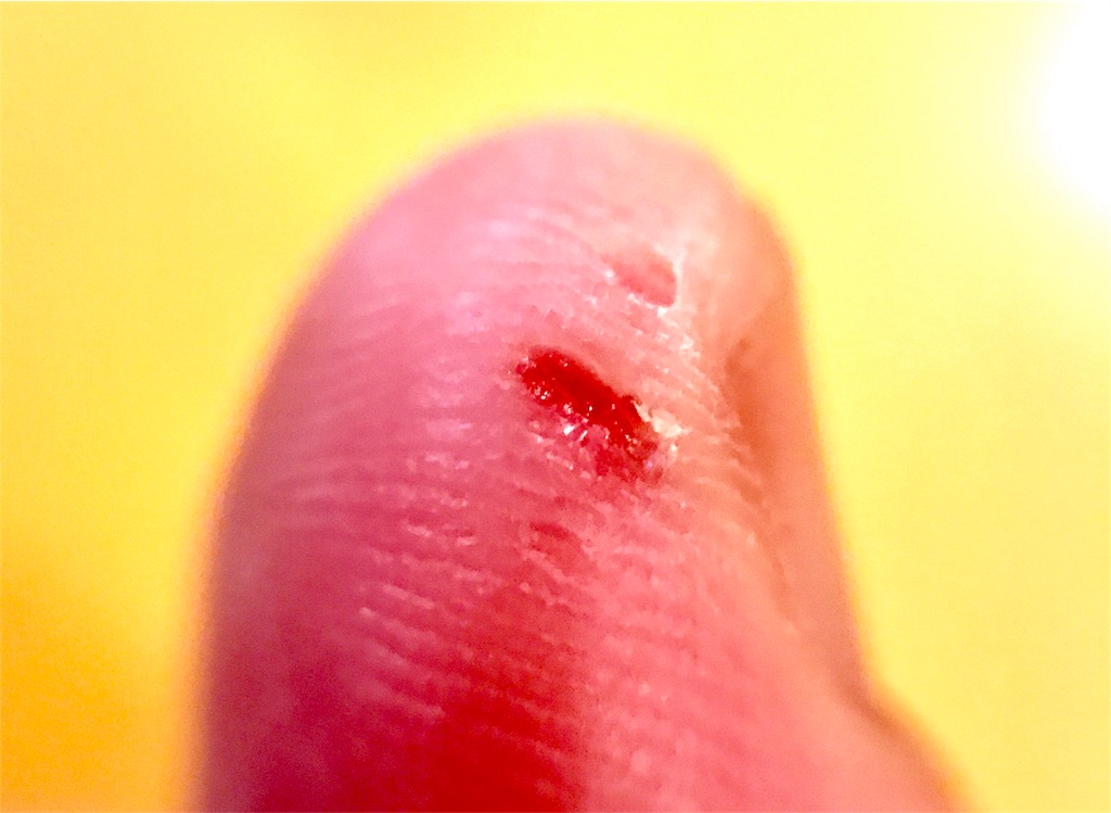 f:id:CHASSESPLEEN:20181230193439j:image