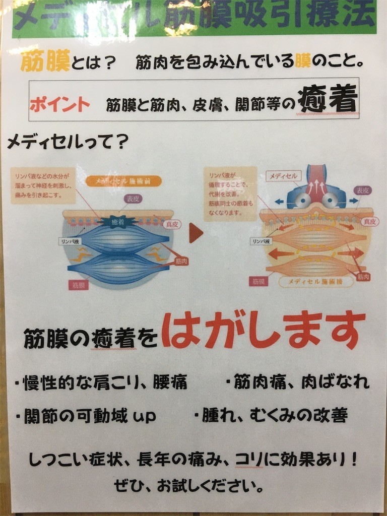 f:id:CLALIS:20210309171519j:image