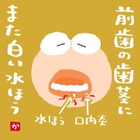 f:id:CSsurvive:20210522003619g:plain