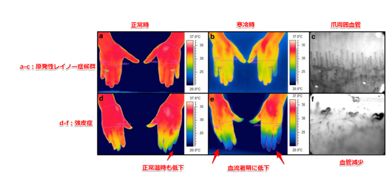 f:id:CTD_GIM:20191029195720p:image f:id:CTD_GIM:20191029195720p:image