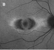 f:id:CTD_GIM:20200524191811p:image