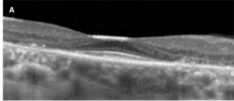 f:id:CTD_GIM:20200524191819p:image