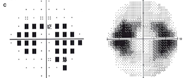 f:id:CTD_GIM:20200524191828p:image