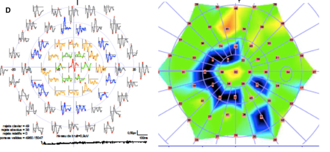 f:id:CTD_GIM:20200524191832p:image