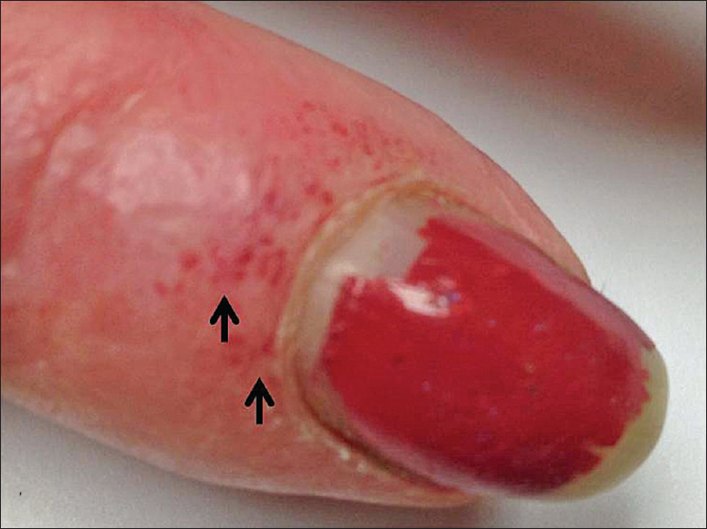 f:id:CTD_GIM:20210416212055j:plain