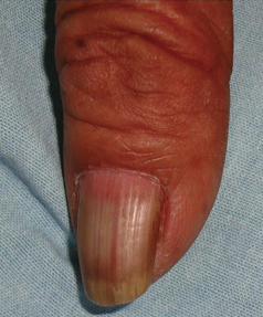 f:id:CTD_GIM:20210416212221p:plain