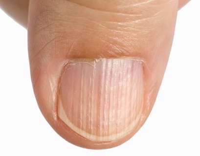 f:id:CTD_GIM:20210416212240j:plain