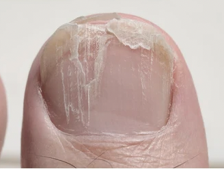 f:id:CTD_GIM:20210416212330p:plain