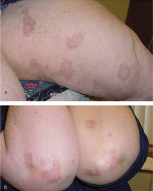 f:id:CTD_GIM:20210618182050j:image