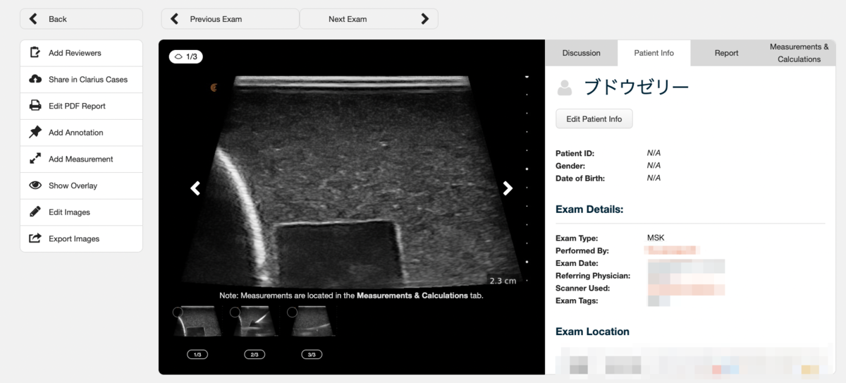 f:id:CTD_GIM:20210821135210p:plain