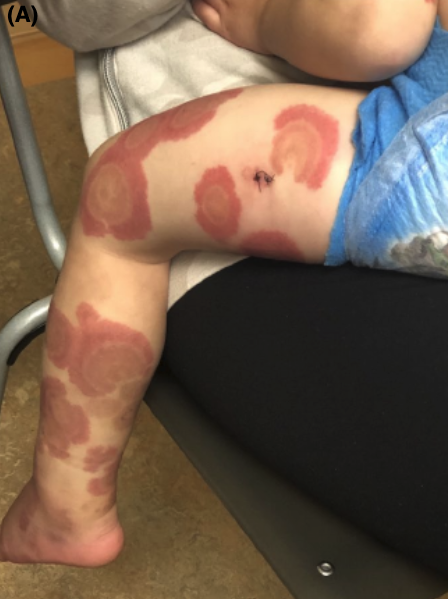 f:id:CTD_GIM:20211029195153p:plain
