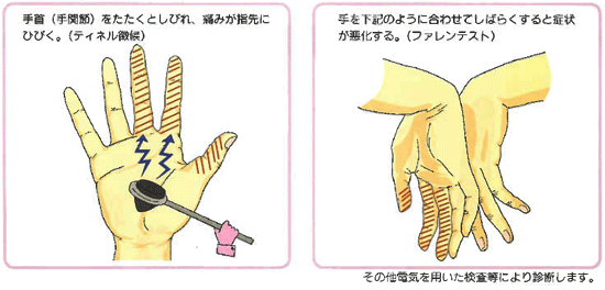 f:id:CTD_GIM:20211125200908p:image